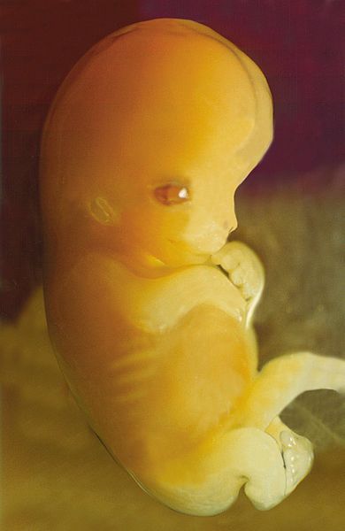 390px-Embryo_7_weeks_after_conception